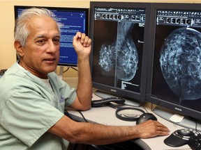 Dr. Winston Ramsewak is shown at Windsor Regional Hospital's Met campus with digital direct radiography mammogram images in May 2014.