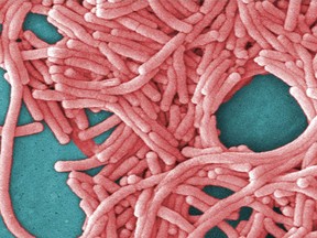 This undated image made available by the Centers for Disease Control and Prevention shows a large grouping of legionella pneumophila bacteria (Legionnaires' disease).
