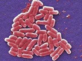 This 2006 colorized scanning electron micrograph image made available by the Centers for Disease Control and Prevention shows a strain of the Escherichia coli bacteria.