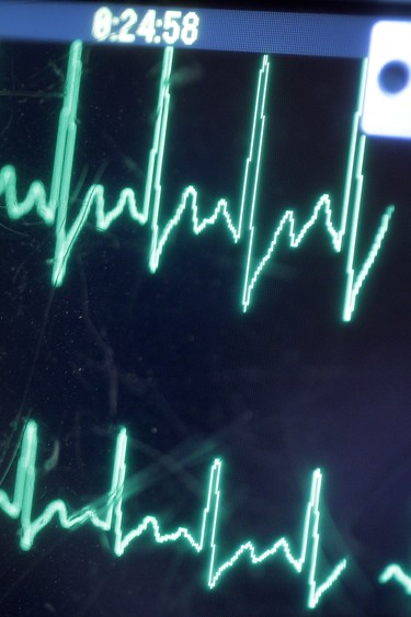 A defibrillator monitor is shown in a St. Clair College medical lab.