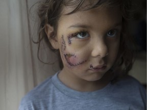 Karma Jariett is pictured at her grandmother's home after being mauled by a dog in West Windsor on Jan. 11, 2018.