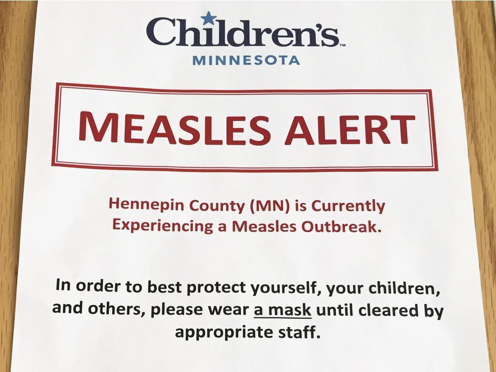 Travellers At Detroit Airport Might Have Been Exposed To The Measles ...