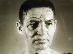 Enhanced photo of Terry Sawchuk shows the battle scars suffered during a violent career between the pipes.