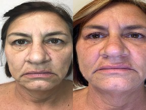 Lea-Ann Suzor glowing new look follows non-invasive treatments