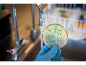 E. coli or coliform bacteria isolated and culture from running supply water. Getty Images.