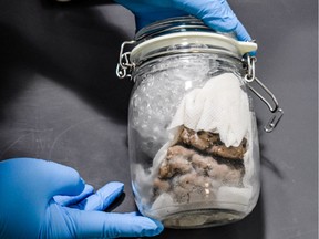 A photo tweeted by Customs and Border Protection officers and agriculture specialists in Port Huron shows a discovered human brain. The brain was found during the inspection of foreign mail.