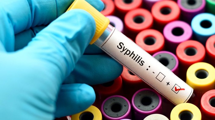 Syphilis rates on the rise in Windsor-Essex