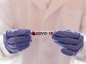 A healthcare worker holds a blood sample with COVID-19 in Wuhan, China.