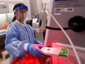 A medical technologist tests a respiratory panel at Northwell Health Labs, where the same test will be used on the COVID-19, the disease caused by the novel coronavirus, after being authorized to begin semi-automated testing by the US Food and Drug Administration (FDA) in Lake Success, New York, U.S., March 11, 2020.