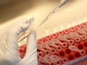 A scientist dilutes samples during the research and development of a vaccine against the coronavirus disease (COVID-19) at a laboratory of BIOCAD biotechnology company in Saint Petersburg, Russia June 11, 2020.