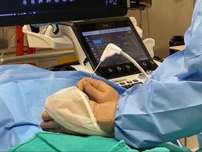 Dr. Matthew Rochon, lead physician for interventional radiology at Windsor Regional Hospital, performs microwave ablation on a liver tumour on Oct. 19, 2020.