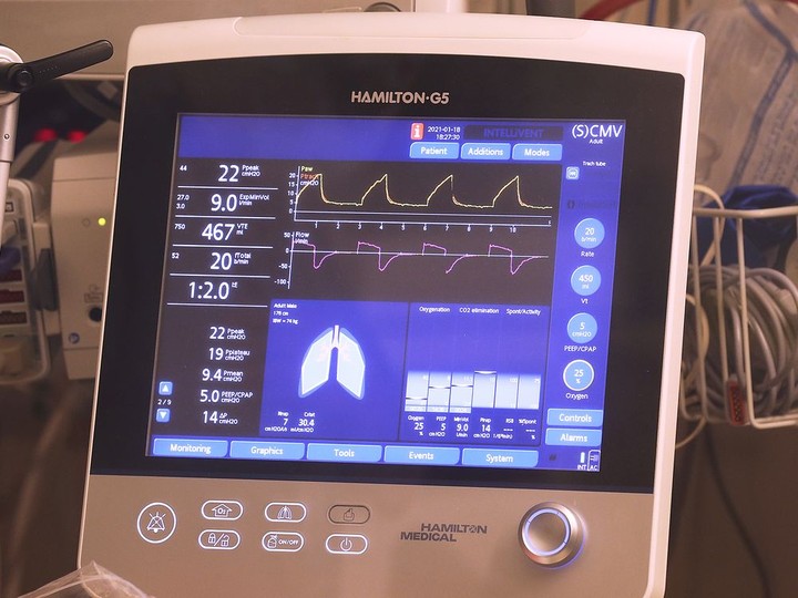  Patient monitoring equipment is shown in the Windsor Regional Hospital Met campus ICU on Monday.