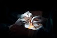 Surgeon Mario Alvarez Maestro (R) and an assistant prepare a kidney for a renal transplantation on patient Juan Benito Druet at La Paz hospital in Madrid on February 28, 2017.