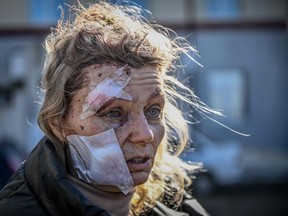 A wounded woman stands outside a hospital after the bombing of the eastern Ukraine town of Chuguiv on February 24, 2022, as Russian armed forces attempt to invade Ukraine from several directions, using rocket systems and helicopters to attack Ukrainian position in the south, the border guard service said. - Russia's ground forces crossed into Ukraine from several directions, Ukraine's border guard service said, hours after President Vladimir Putin announced the launch of a major offensive. Russian tanks and other heavy equipment crossed the frontier in several northern regions, as well as from the Kremlin-annexed peninsula of Crimea in the south, the agency said.