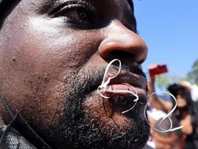 A migrant begins a hunger strike with his mouth sewed shut during a protest to demand free transit through the country outside the office of the National Migration Institute (INM) in Tapachula, Mexico February 15, 2022.