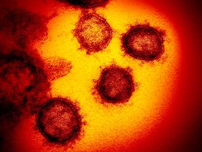 Microscope images of SARS-CoV-2 — the novel coronavirus  behind the disease COVID-19.