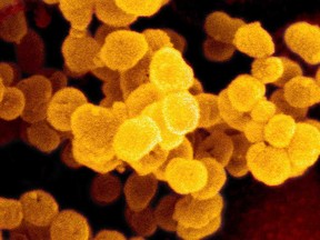 An electron microscope image of the SARS-CoV-2 virus, taken by the U.S. National Institutes of Health in 2020.