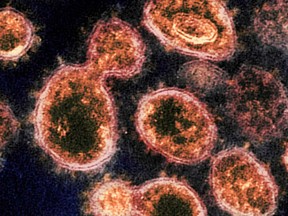 An electron microscope image of SARS-CoV-2 particles. Recorded at the Rocky Mountain Laboratories of the National Institute of Allergy and Infectious Diseases.