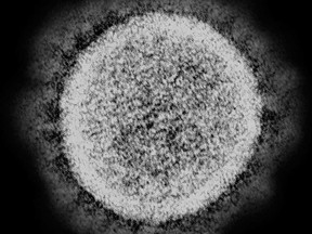 An electron microscope image of a SARS-CoV-2 particle, as captured by the U.S. National Institute of Allergy and Infectious Diseases in 2020.