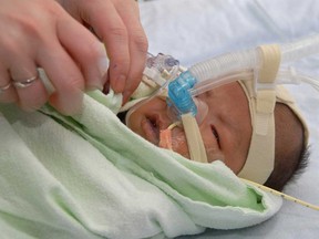 An infant being treated for pertussis (whooping cough) at a hospital in Montreal, Quebec, in 2009.