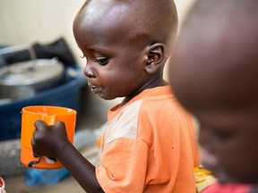 Emmanuel John, a one-and-a-half-year-old malnourished child, drinks milk at the malnutrition ward in Al Shabbab hospital in Juba, South Sudan. (CNW Group/UNICEF Canada)