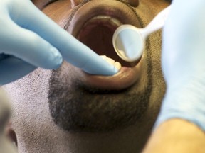 A man gets a dental exam.