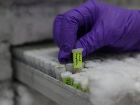 In this file photo taken on May 09, 2016 A technician picks up a sample of frozen DNA.
