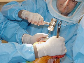 For older patients with osteoarthritis in the knee, arthroscopy is more often than not the wrong choice.
