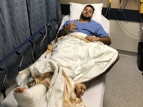 Winnipeg Blue Bombers rookie running back Brady Oliveira tweeted a photo of himself in hospital on Friday, following surgery to repair his broken ankle. The 21-year-old Winnipegger, playing his first CFL game in his hometown on Thursday night against the Edmonton Eskimos, suffered a gruesome ankle injury while blocking on special teams.