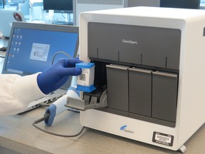 GeneXpert machine at the National HIV and Retrovirology Laboratory at the Winnipeg-based JC Wilt Infectious Diseases Research Centre of the National Microbiology Laboratory, Public Health Agency of Canada.