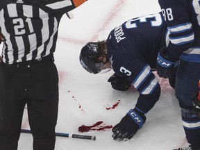 Blood pools on the ice after Winnipeg Jets defenceman Tucker Poolman was struck in the face by a puck while blocking a shot against the Calgary Flames on Tuesday night.
