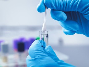 A lab technician processes a sample