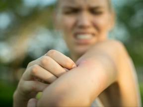 A person rubs and scratches their arm after being bit by a mosquito.