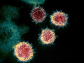 This undated electron microscope image made available by the U.S. National Institutes of Health in February 2020 shows the virus that causes COVID-19.