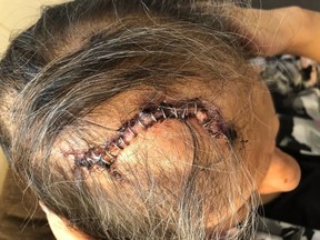 Security guard head injury